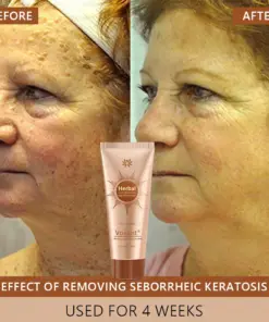 Voilaist® Whitening and Spot-Removing Face Mask