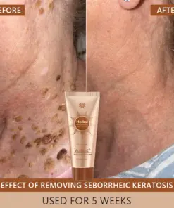 Voilaist® Whitening and Spot-Removing Face Mask