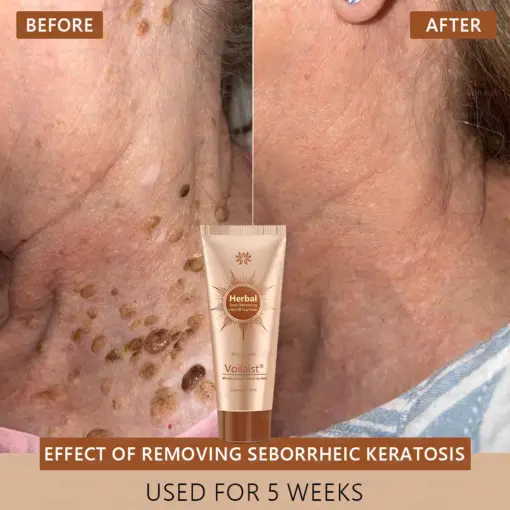 Voilaist® Whitening and Spot-Removing Face Mask