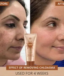 Voilaist® Whitening and Spot-Removing Face Mask