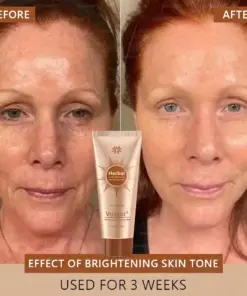 Voilaist® Whitening and Spot-Removing Face Mask