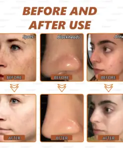 Voilaist® Whitening and Spot-Removing Face Mask