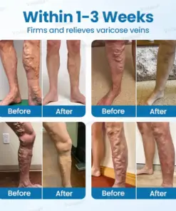 Voilaist® VeinGuard Herbal Spray