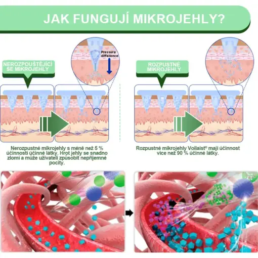 Voilaist® SMGT-GLP-1 Nano Microneedlová Náplast