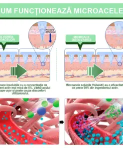 Voilaist® plasture nano cu microace SMGT-GLP-1